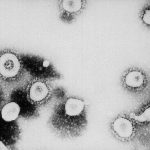 ATLANTA, GA - UNDATED: This undated handout photo from the Centers for Disease Control and Prevention (CDC) shows a microscopic view of the Coronavirus at the CDC in Atlanta, Georgia. According to the CDC the virus that causes Severe Acute Respiratory Syndrome (SARS) might be a "previously unrecognized virus from the Coronavirus family." (Photo by CDC/Getty Images)